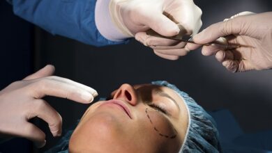 Does Plastic Surgery Impact Your Mental Health