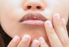 Taking care of your lips in summers
