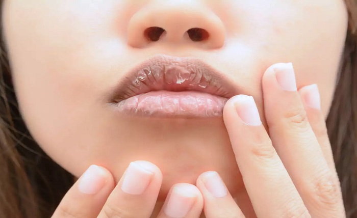 Taking care of your lips in summers