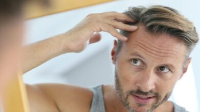 Different Types of Hair Loss